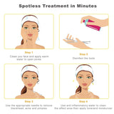 10-Piece: Blackhead Remover Tool