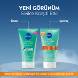 Nivea Derma Skin Clear Acne Fighting Face Peeling - Deep Cleansing, Exfoliant for Acne Prone Skin