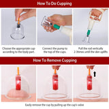 32 Cups Chinese Therapy Set