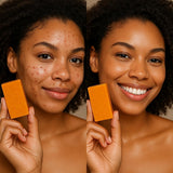 SOAP BARS (Natural)