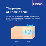 Linola Gentle Shampoo for Sensitive Scalp - 200 ml, Linola Hair Care