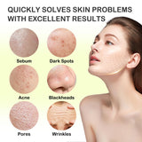 LZYLLS 24 Pcs Clay Face Mask with Brush,Hydrating Mud Face Mask Set,Deep Cleaning Oil Control Clay Facial Masks for Blackheads Remover,Mud Facial Masks Skincare Gift Set