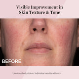 StriVectin Advanced Retinol Intensive Night Moisturizer, Targets Visible Signs of Aging for Healthier Skin, 1.7 Fl Oz