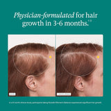 Nutrafol Women's Balance Hair Growth Supplements, for Ages 45+, Clinically Proven for Visibly Thicker Hair and Scalp Coverage, Dermatologist Recommended - 2 Month Supply, 2 Refill Pouches