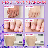 LZYLLS 6 Pairs Hand Masks Moisturizing Gloves, Hydrating Hand Mask Moisturizer Gloves Care for Dry Cracked Hands, Smooth Long Lasting Soft Firming Hand Mask Gift Set for Men Women（A