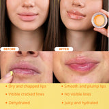 Original My Bee Balm Lip Balm - 4 Pack Hydrating Balm Honey Pot for Dry, Chapped & Cracked Lips with Propolis, Honey & Vitamin E - Soften, Smooth & Reduce Lip Lines