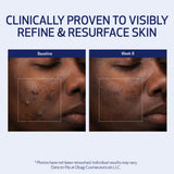 Obagi Medical Retinol + PHA Refining Night Cream - Clinically Proven, Dual-Action, Overnight Anti-Aging Face Cream for Smoother, Renewed Skin & a More Even-Looking Complexion - 1.7 Oz