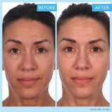 SKINN Crème Reverse with Ferulic Acid, Retinol and Vitamin C-Crème Reverse Intensive-Anti-Aging Cream with Hyaluronic Acid to Plump Skin Vitamin C Help to Improving Tone, Firmness of Skin