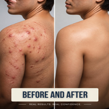 DUO ORGANIC ANTI-ACNE BODY SYSTEM - 6 Fragrances  - For Men