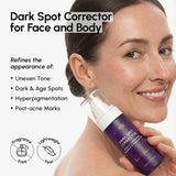 Face & Body Serum for Dark Spots