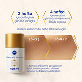 NIVEA Luminous Stretch Mark Serum - Body Moisturizer for Stretch Marks with LUMINOUS630, Long-Lasting Hydration & Anti-Stretch Mark Body Oil