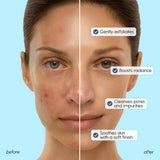 Face Polishing Scrub & Exfoliator