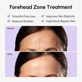 Anti-Wrinkle Forehead Patches