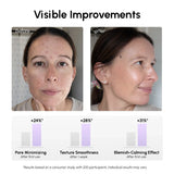 12% Niacinamide Smooth & Glow Pads