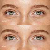 Pink Eye Patches for Puffy Eyes