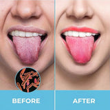Tongue Cleansing Gel Tongue Coating Removal Kit Removing Thick White Tongue Coating,Balance Flora Freshing Breath Oral Care Tool