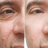 Retinol Anti-wrinkle Cream For Men Collagen Anti-Aging Removal Face Neck Wrinkle Efficient Moisturizing Firming Korean Skin Care