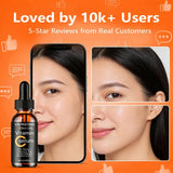 YOUNGCOME Vitamin C Hyaluronic Acid Serum - Daily Hydrating & Radiance-Boosting Facial Essence for All Skin Types 40/60ML