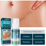 Skin Care Cream Scars Repair Gel Face Body Lotion Smoothing Hydrating Stretch Marks Cream Post Surgery Scar Care Gel Moisturize