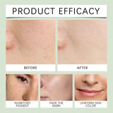 HOYGI Hyaluronic Acid Cleanser Anti Acne Oil Control Blackhead Remover Skin Cleansing Gel Brightening Pore Cleaning Face Wash