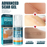 Skin Care Cream Scars Repair Gel Face Body Lotion Smoothing Hydrating Stretch Marks Cream Post Surgery Scar Care Gel Moisturize