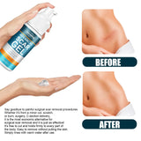 Skin Care Cream Scars Repair Gel Face Body Lotion Smoothing Hydrating Stretch Marks Cream Post Surgery Scar Care Gel Moisturize