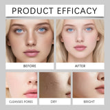 HOYGI Facial Cleansing Gel Oil Control Moisturizing Face Wash Anti-Acne Pore Refining Blackhead Remover Gentle Brightening Skin