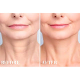 Reusable Anti Wrinkle Chest