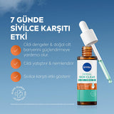 Nivea Acne Control Facial Serum - Balances Oily Skin, Reduces Acne - 1.01 fl oz