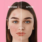 Sinoz Pink Touch SPF50+ Tone-Up Sunscreen: Color Correcting, Redness Reducing, and Brightening Mineral Facial Sunscreen with Hyaluronic Acid - 1.69 fl oz