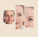 The Eraser Spot Cream | Dark Spot Corrector