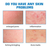 EELHOE Hyaluronic Acid Essence - Hydrating and Repairing, Diminishes Facial Acne Marks, Skin Care Whitening Essence