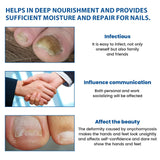 Ximonth Nighttime Renewal Fungal Nail Patches, And Thickening Gray Nail Insert Soft Nail Care Patch