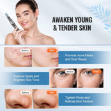 VEVOR Professional Microneedling Pen, Electric Derma Pen with 5PCS * 16Pin Disposable Cartridges, 6 Variable Speed Skin Care Beauty Device with LCD Display and 0-2.5mm Adjustable Needle Length
