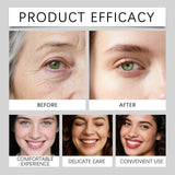 AMZ Eye Cream Hydrating and Moisturizing Care for Eye Skin Gentle Ingredients Watery Massage Daily Care Eye Cream