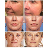 Facial Firming Cream Repair Skin Whitening Wrinkle Remover Dilute Lighten Face Neck Fine Lines Skin Care Brightening Cream