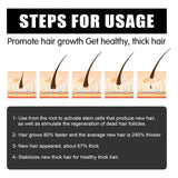 Hair Micro 540 Roller Derma Roller Dermaroller Titanium Promot Hair Regrowth Beard Growth Anti Hair Loss Treat Thinning Receding