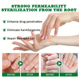 Ginger Nail Care Liquid Onychomycosis Fungus Repair Hand and Foot Nail Care