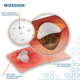 McKesson Silver Antibacterial Wound Gel