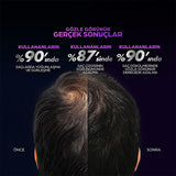 Clear Men Scalp Pro: Advanced Hair Growth Serum for Men - Clinically Proven Hair Loss Treatment - Strengthens & Thickens Hair for Increased Density