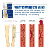 Pain Relief Leg Spider Veins Vasculitis Promote Circulation Smooth Metabolism 30g Exfoliation