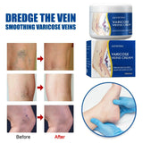 Pain Relief Leg Spider Veins Vasculitis Promote Circulation Smooth Metabolism 30g Exfoliation